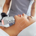 hifu treatment signature beautylounge